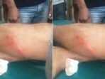 LintangPos.com_20250913_170745_0000 Arpan (55), warga Desa Pauh I, Muratara, jadi korban pembacokan saat membeli rokok di warung. Pelaku berinisial BG kabur, polisi masih melakukan pengejaran.